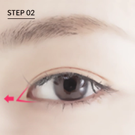 眼角整形 前眼角后眼角,开前眼角,前眼角案例,眼角下至,眼角整形副作用