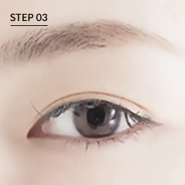 眼角整形 前眼角后眼角,开前眼角,前眼角案例,眼角下至,眼角整形副作用