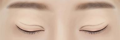 男士眼部修复术 男士眼部修复,男士眼部整形,男士眼部手术,男士整形,男士眼部整形副作用