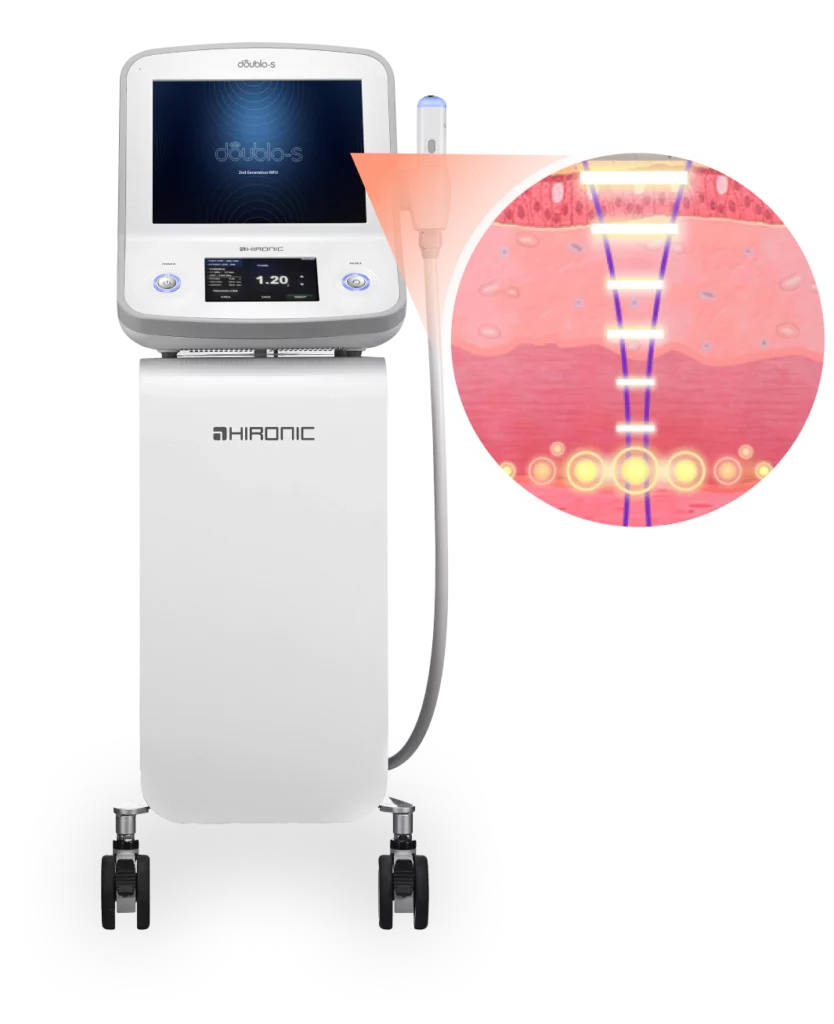 展现提拉原理的韩版超声刀设备.