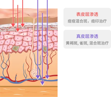 選擇性地破壞導致色素疾病的黑色素,打造乾淨明亮的肌膚.