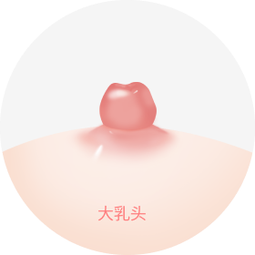 形态过大的乳头。
